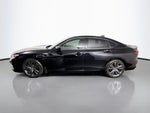 2022 Acura TLX A-Spec Package SH-AWD